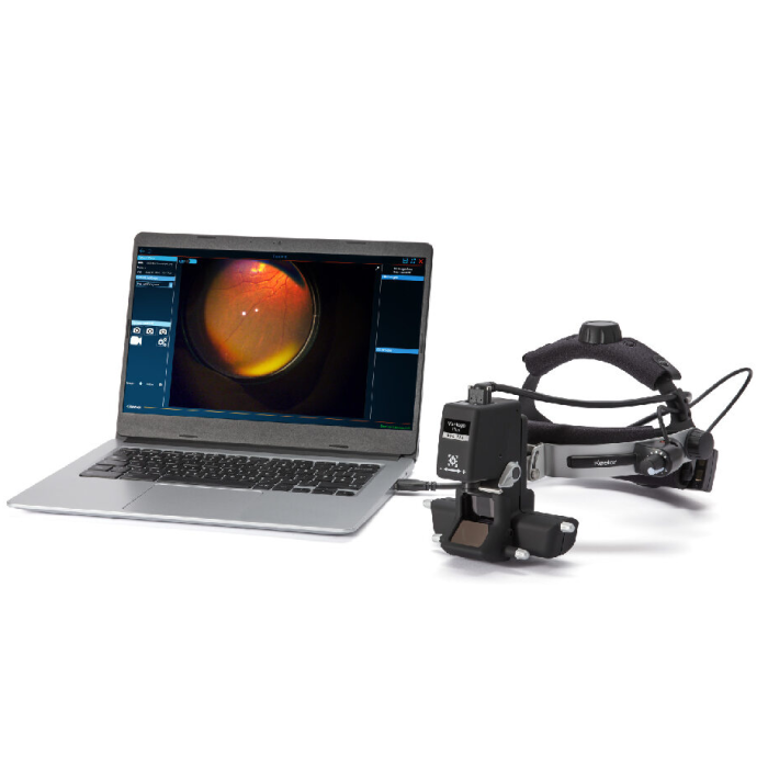 Vantage Plus Digital - Keeler