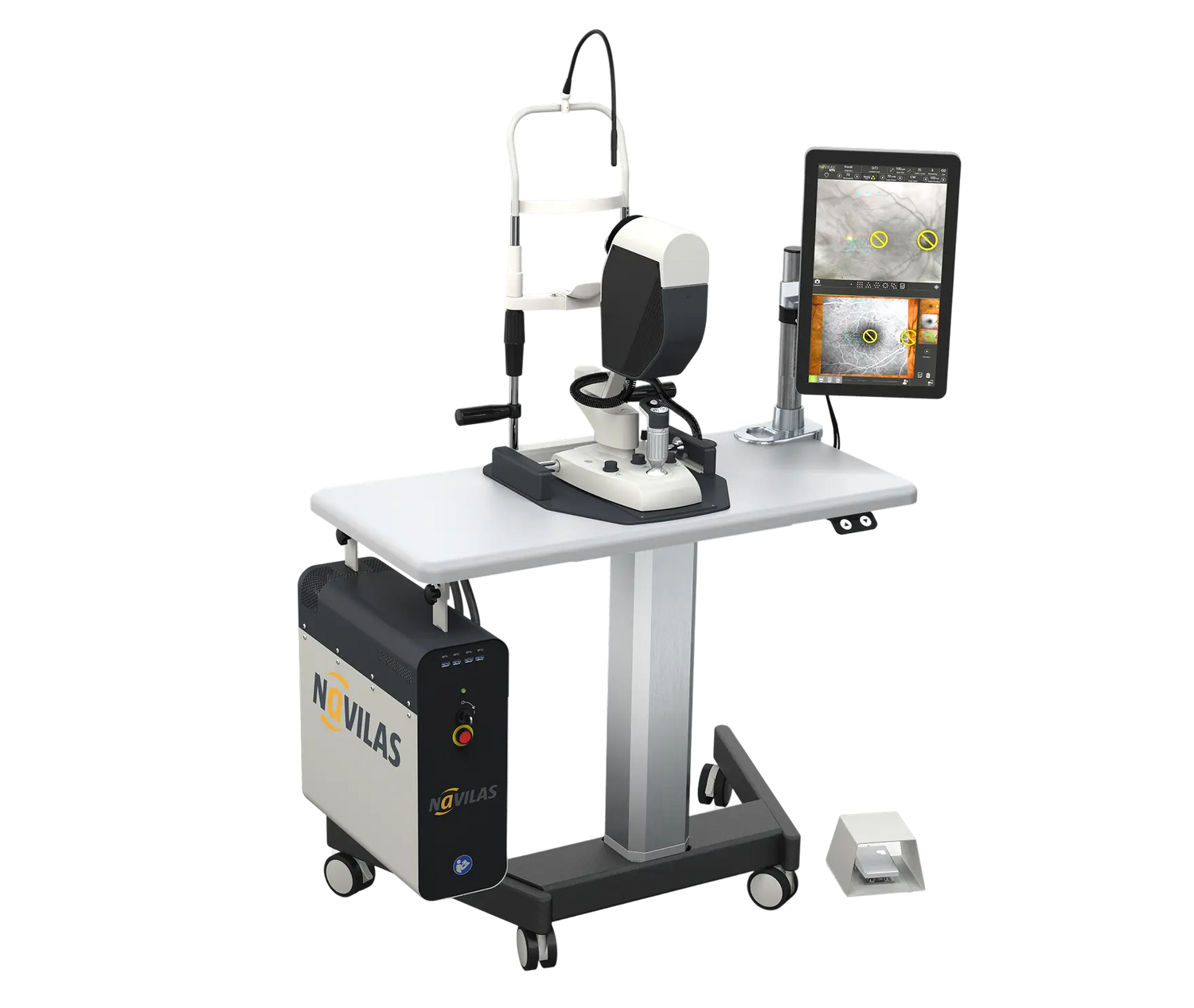 Retina Navigation Laser Therapy