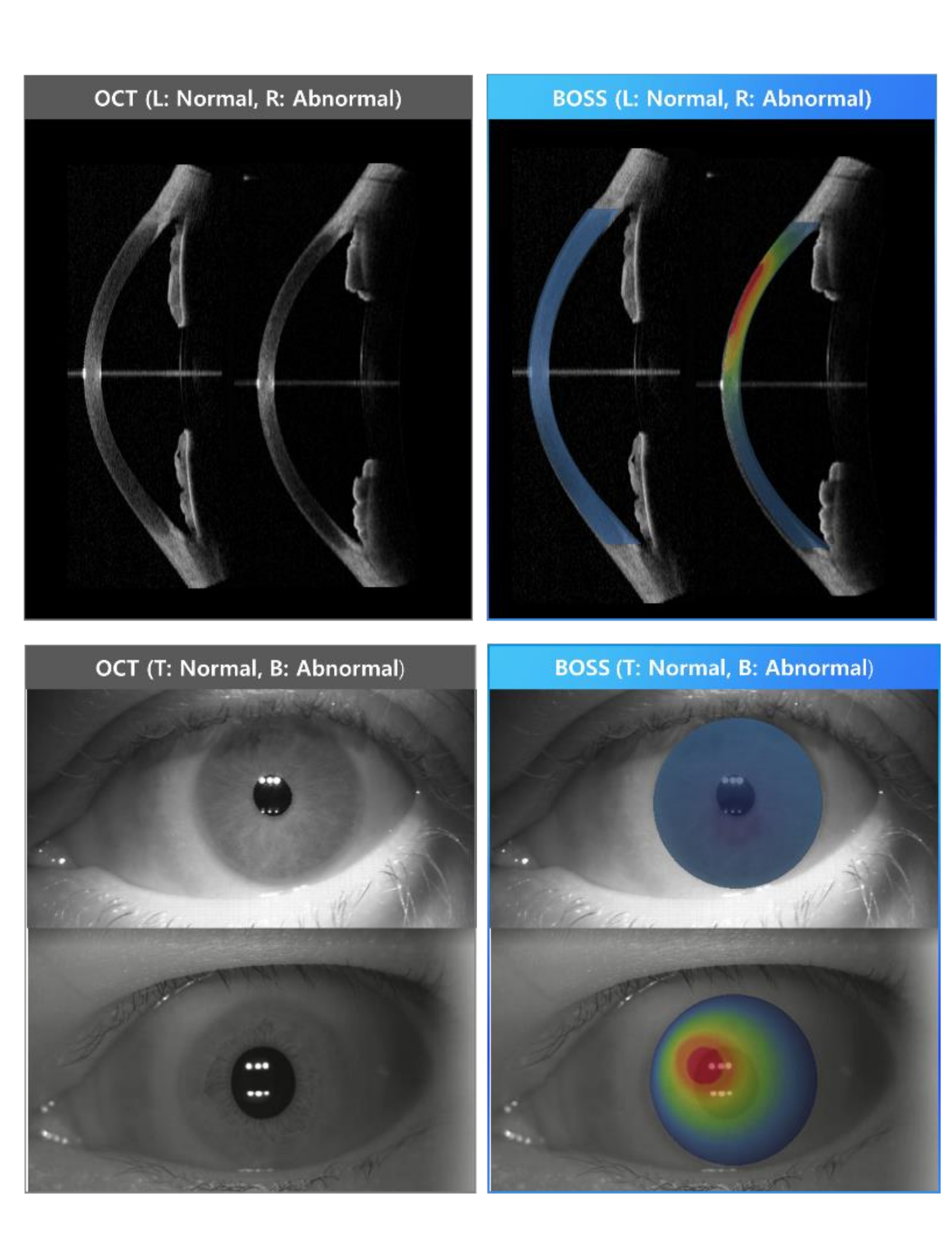 BOSS - Intelon Optics