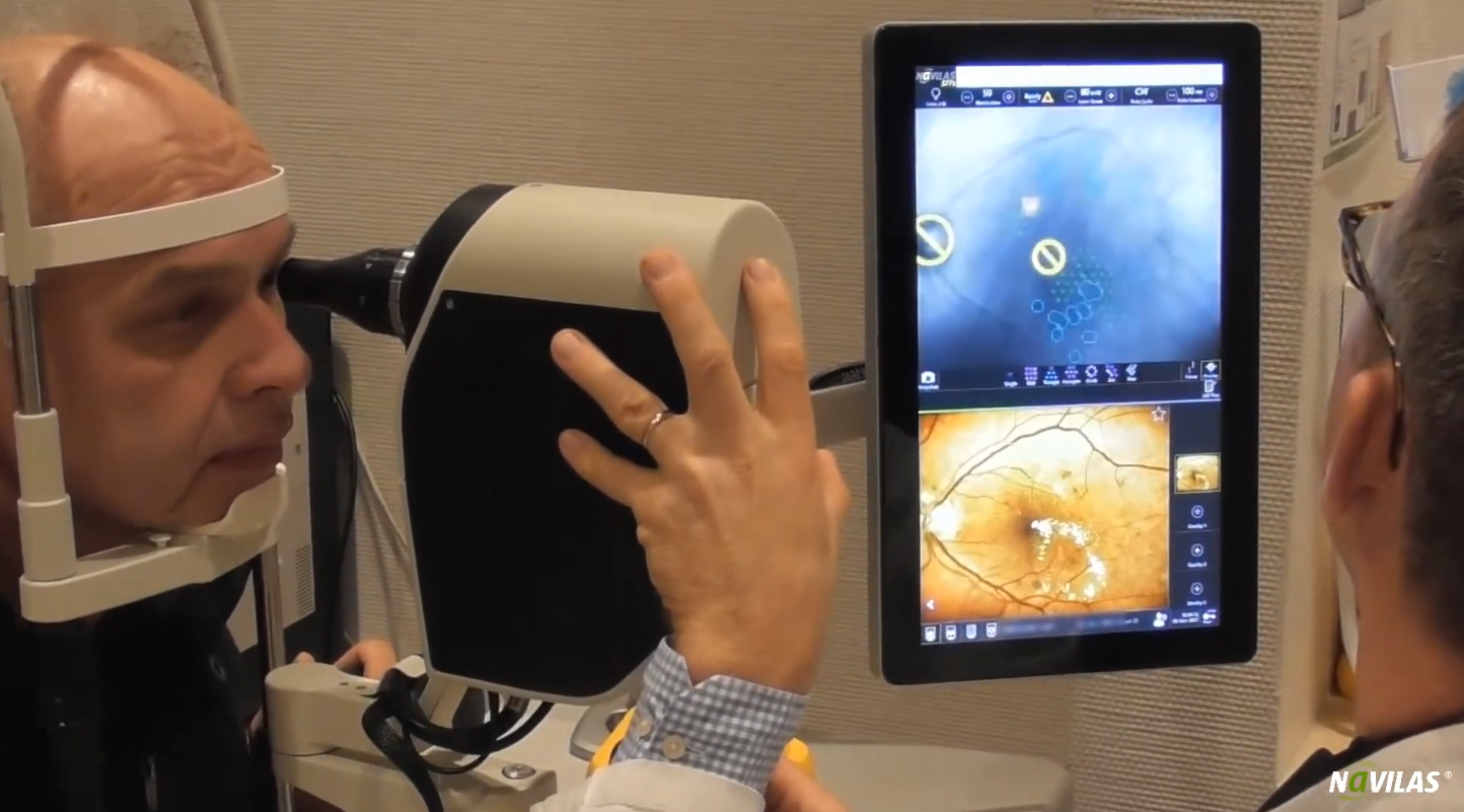 Load video: Navilas Retina Laser