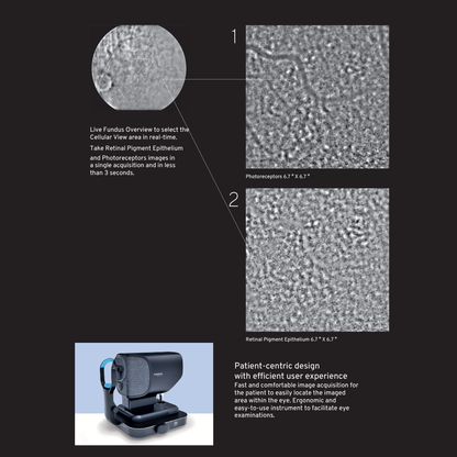 CELLULARIS® Discovery showing live fundus overview with cellular-level images of photoreceptors and retinal pigment epithelium, acquired in under 3 seconds. Includes patient-centric design of the imaging device.