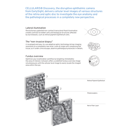 CELLULARIS® Discovery retinal imaging technology by EarlySight, highlighting lateral illumination, non-invasive biopsy via adaptive optics, and fundus overview with cellular-level images of the retinal pigment epithelium, photoreceptors, and nerve fiber layer.