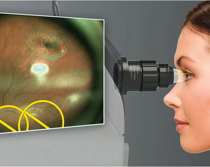 Navilas 577s Laser System - OD-OS